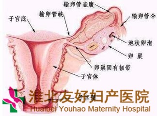 怎样做好附件炎的预防保健工作