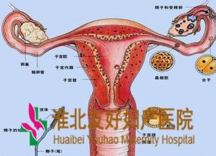 宫颈癌容易出现哪些治疗误区